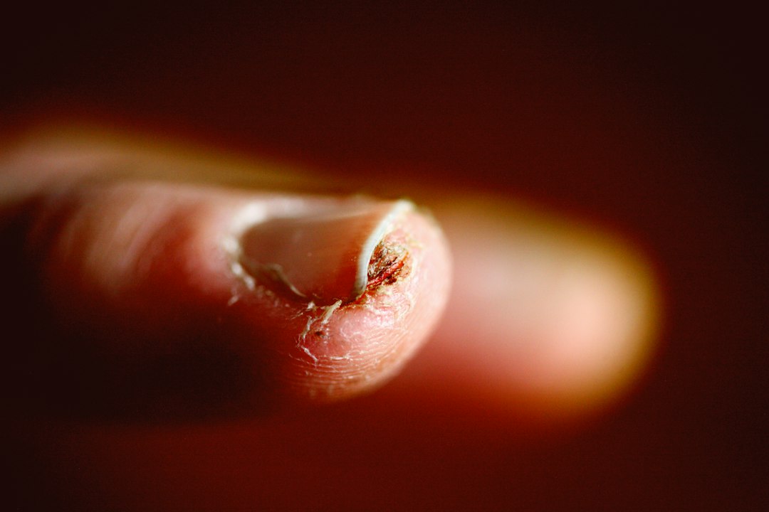 How Brittle Nails Form: Why Your Nails Break and Split (Science Explained)